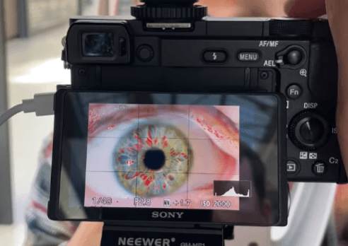 We Capture Your Iris